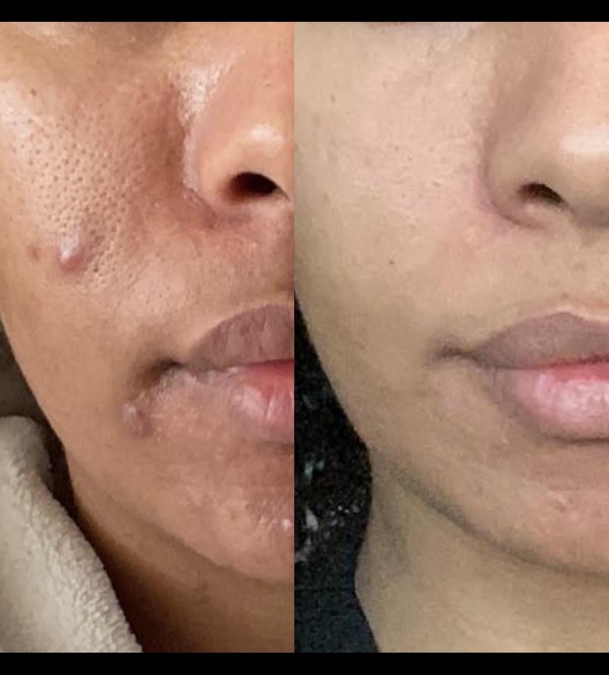 Customer before and after the qasil routine